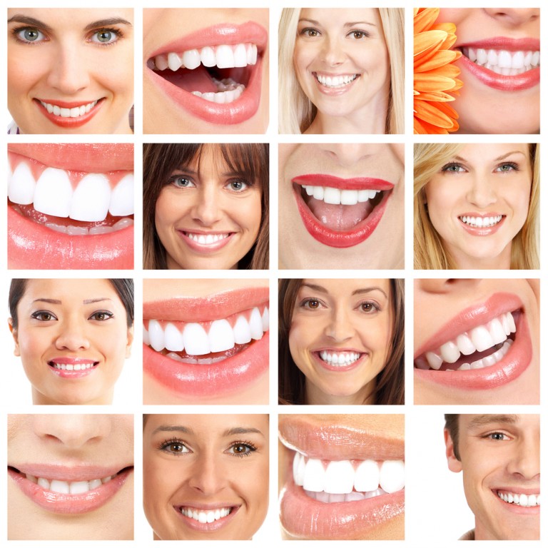 Benefits of Lemon Juice, In Contrast To Its Effects On Tooth Enamel