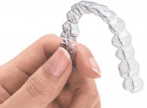 3D Printed Dental