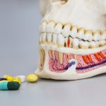 Antibiotics for Gum Disease Best Prescription and OTC Options