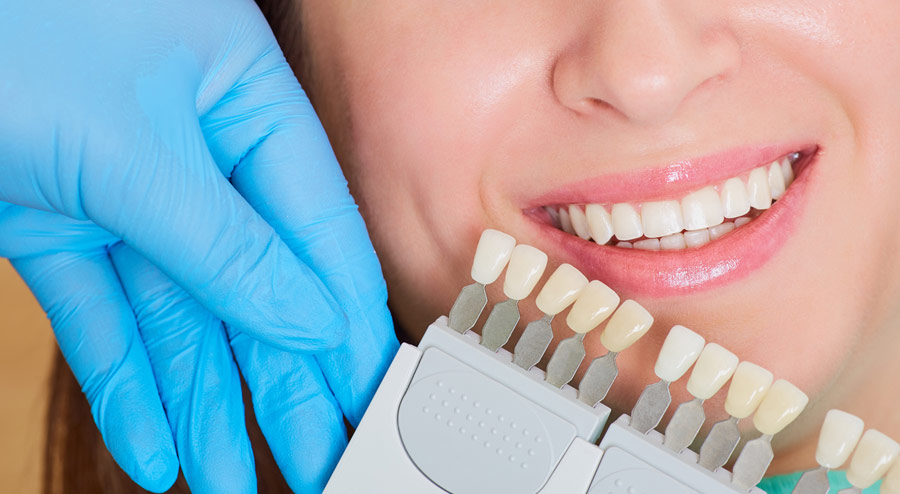 Vinegar for Teeth Whitening
