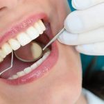 Bone Loss in Teeth, Have a Bone Loss around Your Teeth