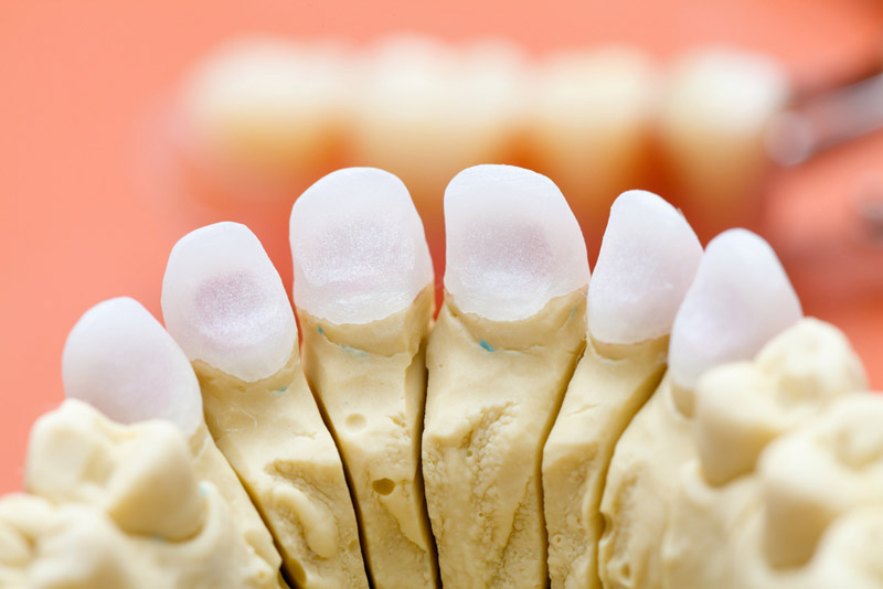 CEREC Crowns