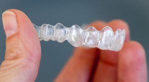Clear retainers