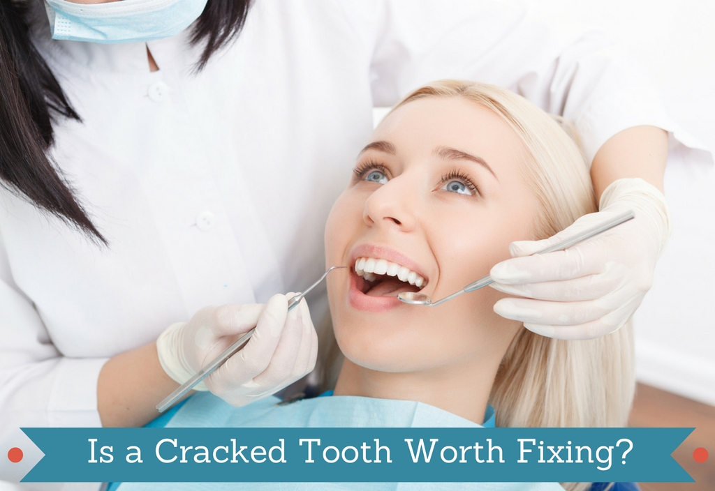 Is a Cracked Tooth Worth Fixing