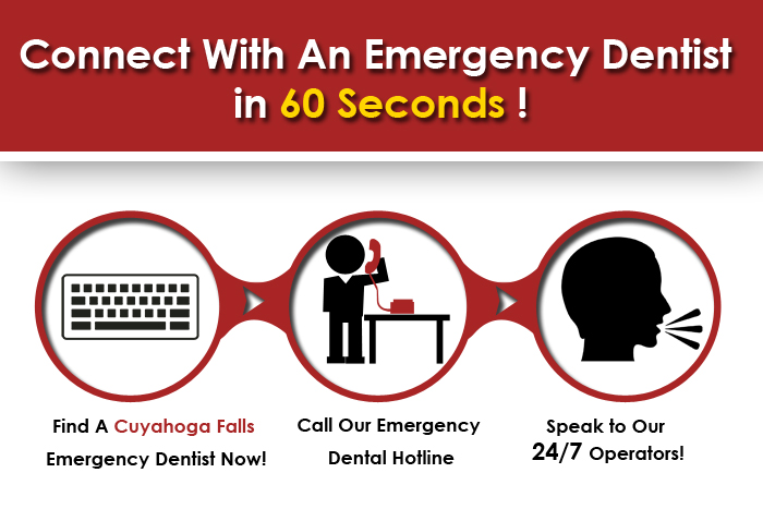 emergency dental Cuyahoga Falls OH