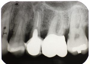 Dental X-ray