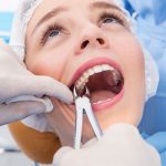 How Supplemental Dental Insurance Works