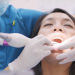 Expander Teeth FAQs and General Info