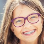 Gum for Braces The Surprising Benefits of Chewing Gum with Braces