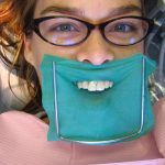 Handling Chipped Teeth