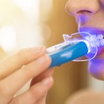 How Blue Light Teeth Whitening Works