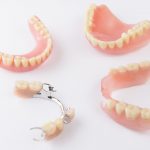 How Partial Dentures Works