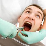 How to Prevent Dry Socket after a Tooth Extraction