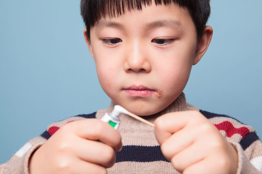 Toothpaste on Cold Sores Is Toothpaste Good for Cold Sores?