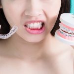 Invisalign vs. Braces Which Is Right for You