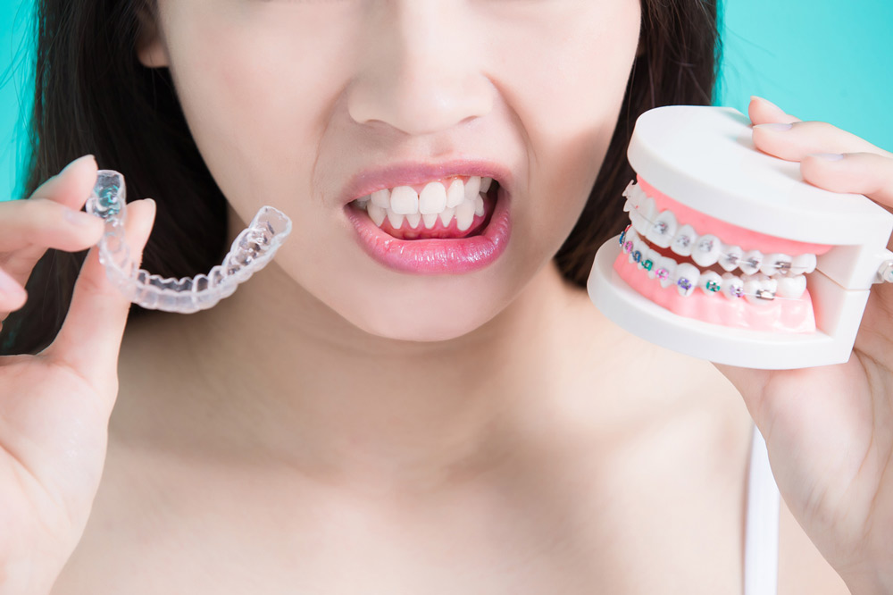 Invisalign vs. Braces Which Is Right for You