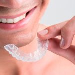 Is Invisalign Worth It - Invisalign Facts You Need to Know in 2018