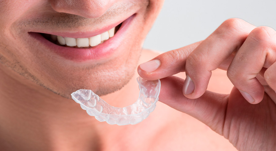 Is Invisalign Worth It - Invisalign Facts You Need to Know in 2018