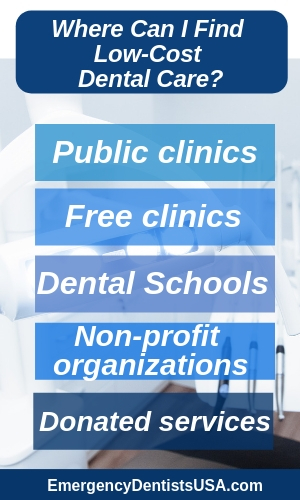 Why Most composite fillings Fail
