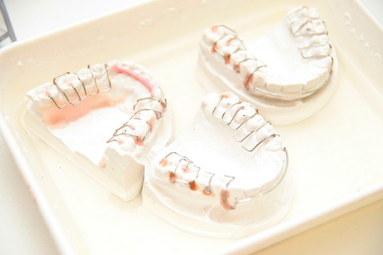 Nance Appliance What It Is & When Should You Use It?