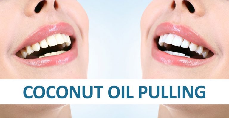 Does coconut oil whiten your teeth