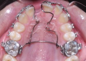 Orthodontia