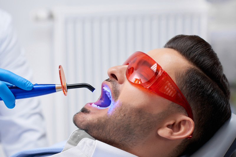 Procedures for Teeth Whitening