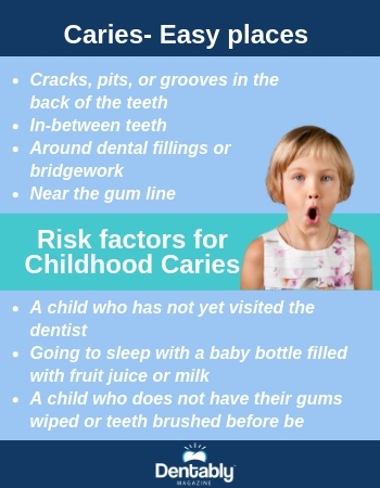 Risk factors for Childhood Caries