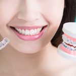 Teeth Retainer Options to Reduce Pain