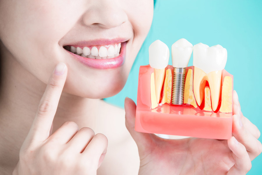 The Cons of Dental Implants