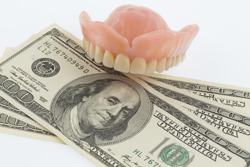 The Costs of CEREC Crowns