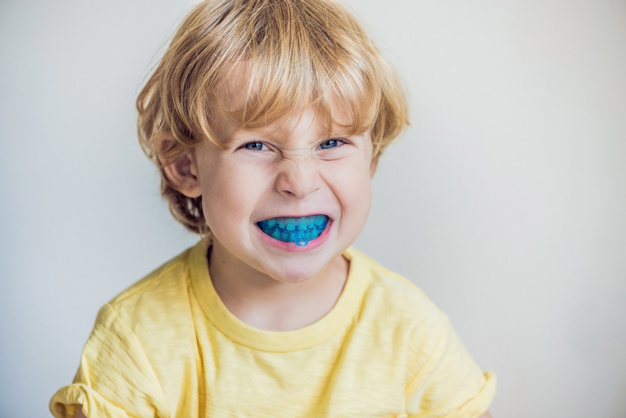 The Numerous Effects of Bruxism on Children