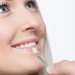 Veneer Teeth Pros and Cons