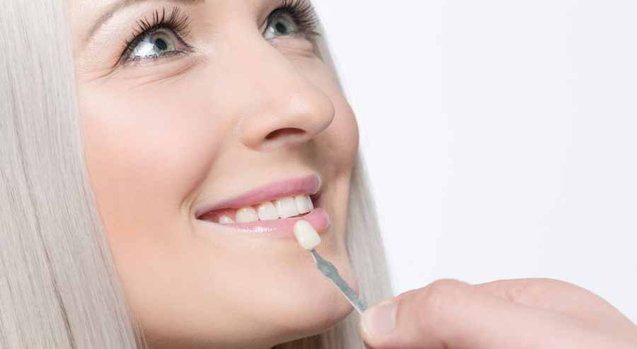 Veneer Teeth Pros and Cons