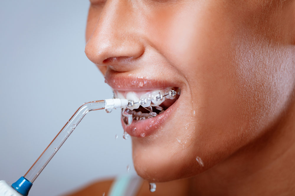 Water Flossers More Effective