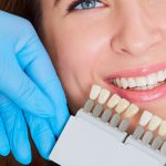 What Are the Best Types of Dental Crowns for Teeth