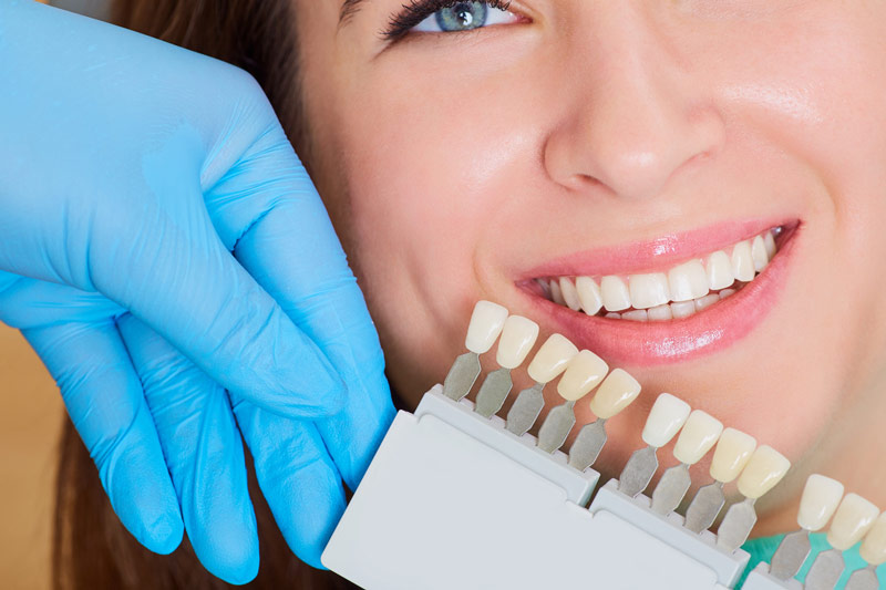 What Are the Best Types of Dental Crowns for Teeth