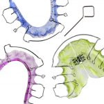 What Is a Palatal Expander & Why Is It Needed