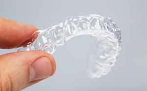 What Is an Essix Retainer