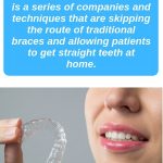 What are At Home Orthodontics – Clear Aligners