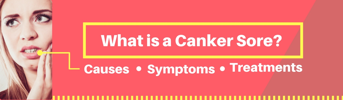 What is a Canker Sore-