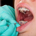 What is an Orthodontist and What Do They Do