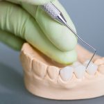 When a Dental Inlay Is Your Best Option
