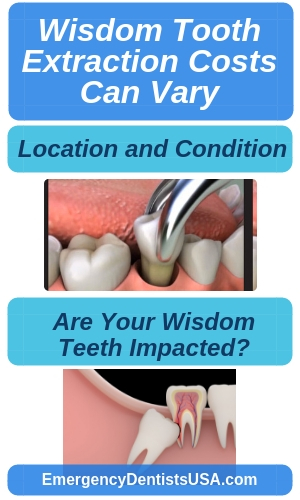 Wisdom Teeth Removal Near Me - No Insurance Extractions 24/7