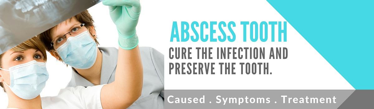 abscess tooth