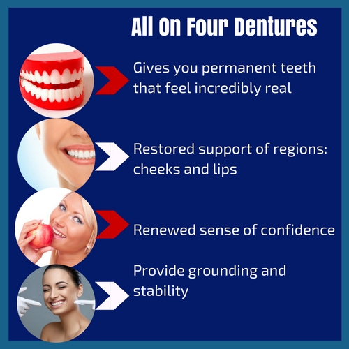 all on four dental