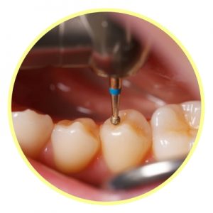 Soft teeth shop