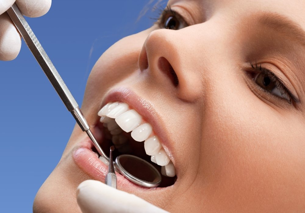 Cosmetic Dentist San Jose, Ca Find Aesthetic Dentist