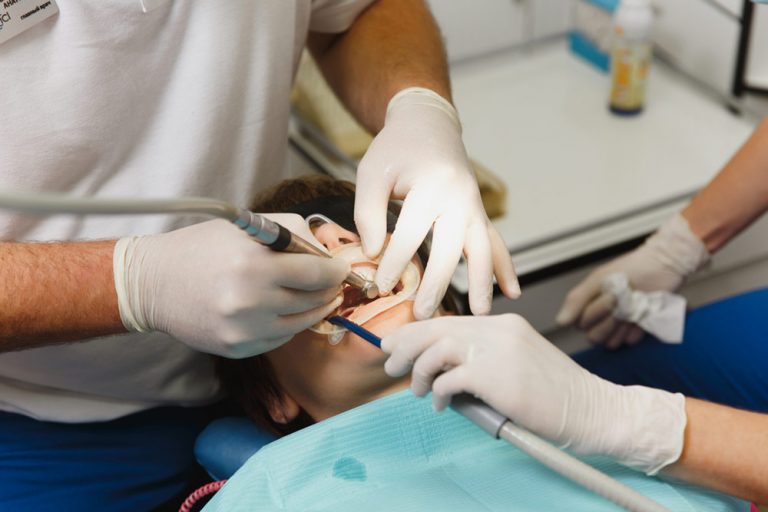 Best Temporary Crown Cement & Method to ReCement Crowns in 2018