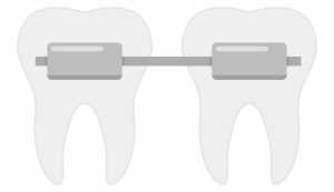 dental brace teeth space image